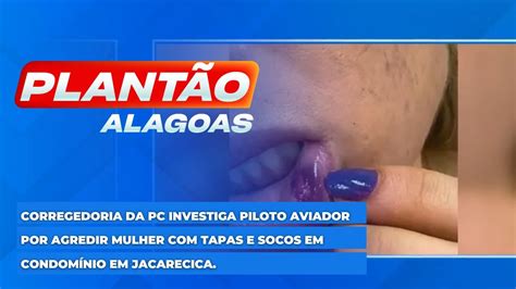 Corregedoria Da PC Investiga Piloto Aviador Por Agredir Mulher