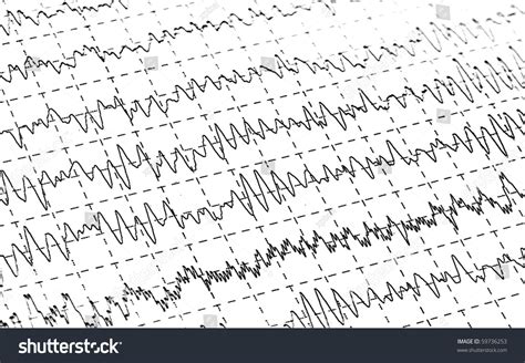 Brain Waves On Encephalogramme Eeg White Stock Photo 59736253 ...