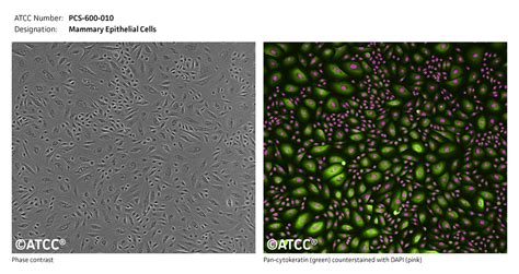 Primary Mammary Epithelial Cells Normal Human Hmec Pcs 600 010 Atcc