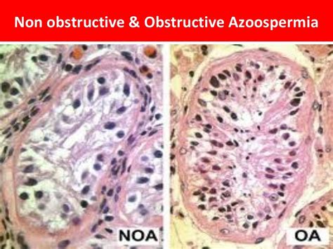 Testicular Biopsy Slides