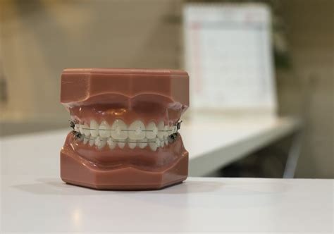 Understanding Your Insurance Orthodontic Lifetime Maximum