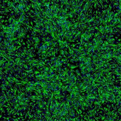 Human Retinal Pigment Epithelial Cells Innoprot Ocular Cell System