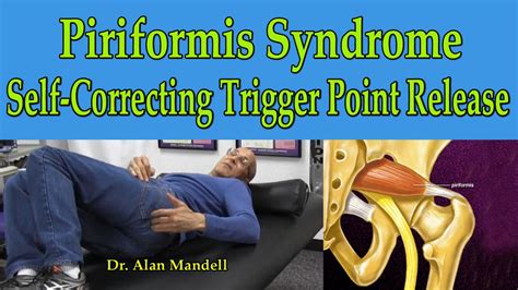 Piriformis Trigger Point Release