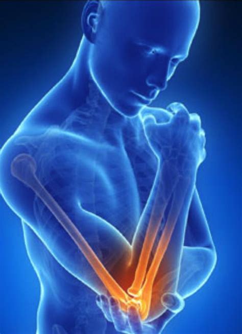 Tennis Elbow/ Lateral Epicondylitis - Home Care Dubai - MRod Healthcare