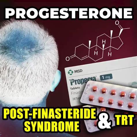 More Plates More Dates On Twitter Progesterone Use For Post