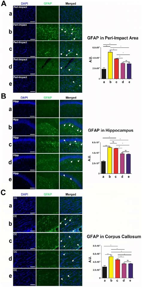 Glial Fibrillary Acidic Protein Gfap Green With Dapi Blue