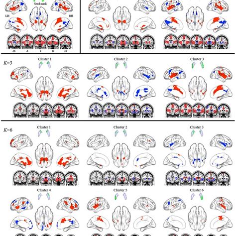 Functional Connectivity Maps Of The Entire Putamen And Its Subdivisions Download Scientific