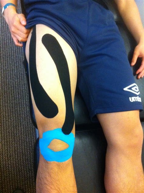 Kinesio Taping Dr Soroush Khoshroo Chiropractor