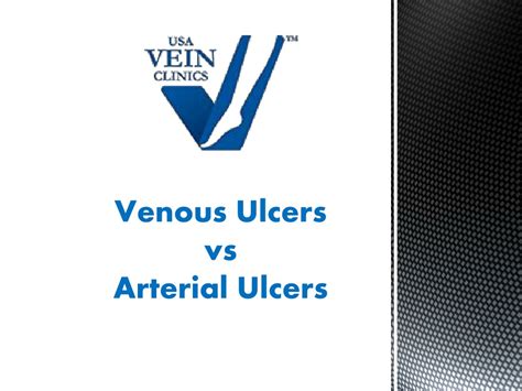 Ppt Venous Ulcers Vs Arterial Ulcers Usa Vein Clinics Powerpoint Presentation Id 9836740