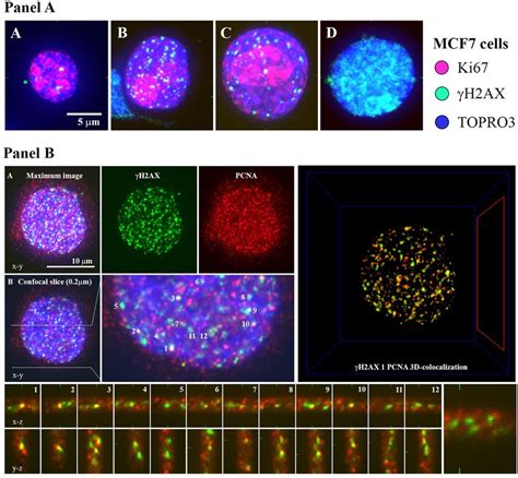 Cells With H Ax Bp Foci Are S Phase Cells With Collapsed