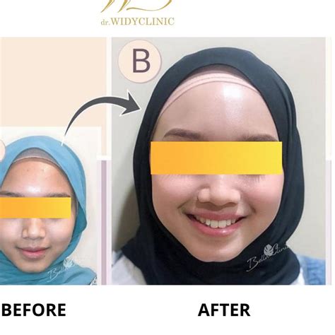 Jual Skincare Whitening Dr Widy Clinic Produk Satuan Krim Serum Sabun