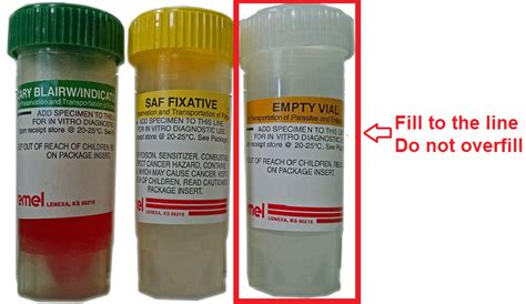 Clostridioides Difficile Toxin PCR Infectious Disease Only