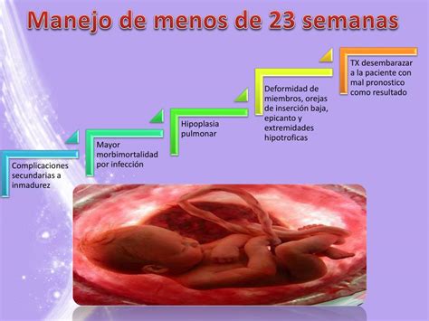 Ppt Ruptura Prematura De Membranas Powerpoint Presentation Free