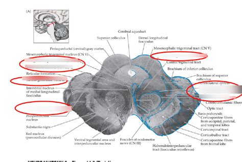 Rostral Midbrain Diagram Quizlet