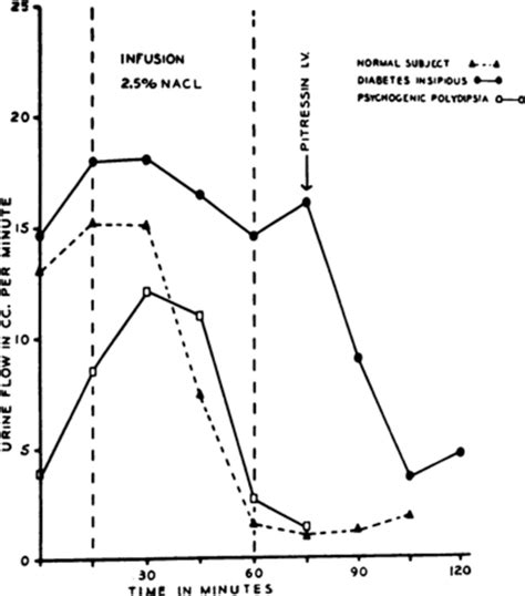 Psychogenic Diabetes Insipidus In Journal Of Neurosurgery Volume 23