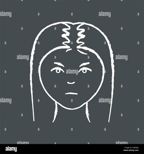 Female Hair Chalk White Icon On Black Background Woman With Alopecia