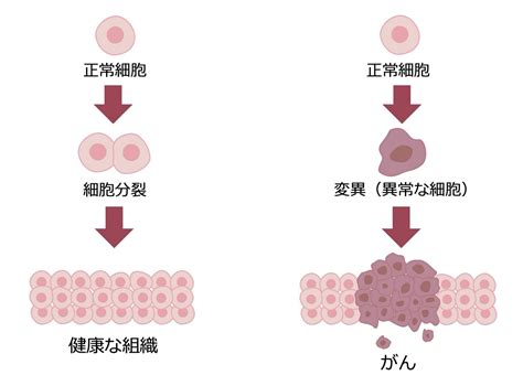 がんを早期発見するために。知っておきたいがんのコト ミッドタウンクリニック名駅｜jpタワー名古屋の人間ドック・健康診断