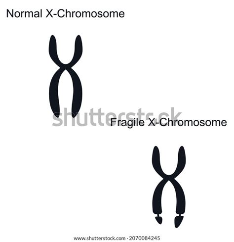 Fragile X Syndrome Genetics Logo Icon Stock Vector Royalty Free 2070084245 Shutterstock