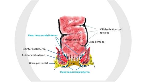 Sintomas De Ulcera Anal Telegraph