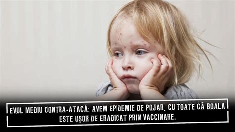 Evul Mediu Contra Atac Avem Epidemie De Pojar Cu Toate C Este U Or