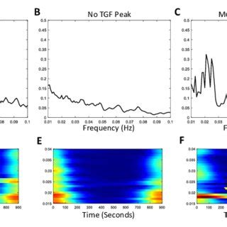 Three Types Of TGF Induced Responses In Different Vessels The Top