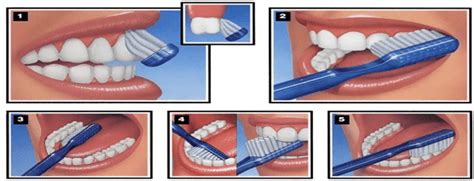 How To Brush Your Teeth The Vallance Dental Centre