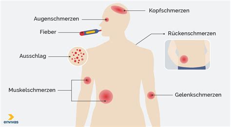 Dengue Fieber Eine Tropenkrankheit Breitet Sich Aus