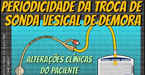 O Tempo De Troca De Uma Sonda Vesical De Demora Enfermagem Ilustrada