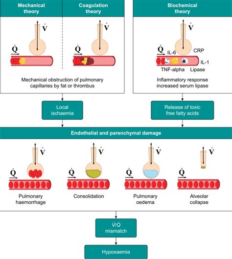 Fat Embolism Syndrome Bja Education