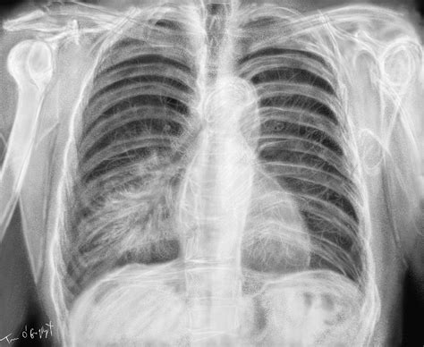 Bewertung Daten Boden Pneumonie Radio Tatsache Schwierig Chemiker