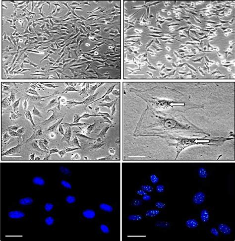 Morphological Changes And Senescence Induction By Mentha Piperita