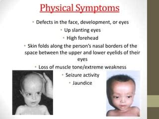 Zellweger Syndrome Ppt