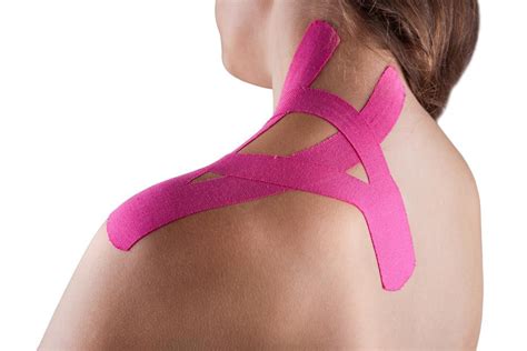 Kinesio Taping Chiropractor In St Joseph