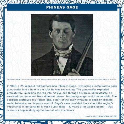 Phineas Gage Book