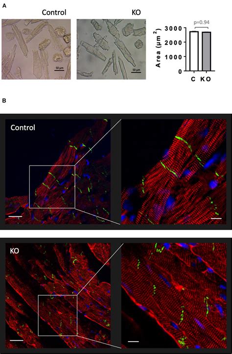 Frontiers Role Of Cardiac Activated Protein Kinase In A Non