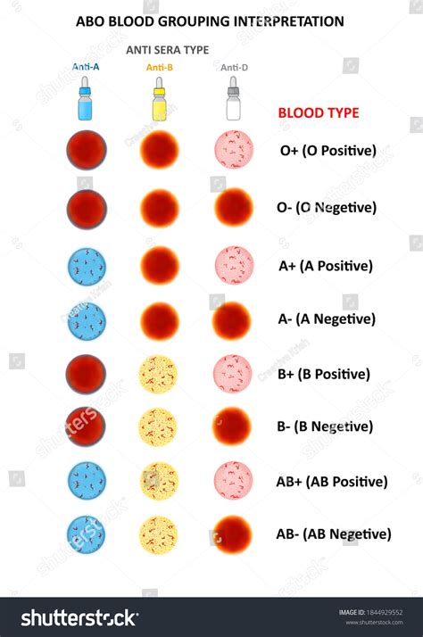 Determination Of Abo And Rh Blood Typing Of Abo Rh Blood 47 Off