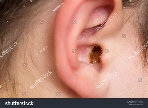 Ear Wax Black Colour Clipart