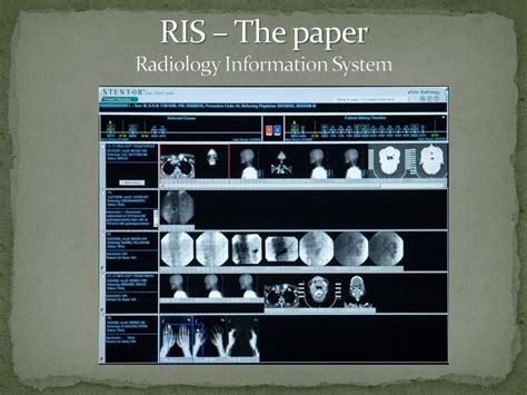 Ppt An Integrated Pacs Ris Solution Making It Work For The Patient Powerpoint Presentation