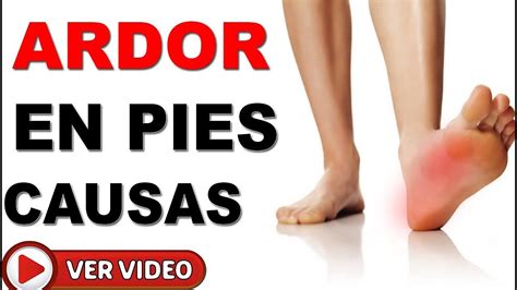 Ardor Y Hormigueo En Los Pies Y Piernas 6 Causas Y Como Tratarlo YouTube