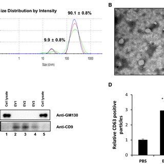 Isolated Extracellular Vesicles Evs From The Serum Samples Of