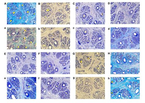 Representative Hair Follicle Groups At Horizontal Sections Stained By