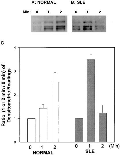 Time Curve Of The Anti Cd Mab Mediated Lupus T Cell Protein Tyrosine