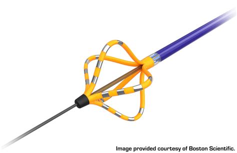 Traitement De La Fibrillation Atriale Avec Des Dispositifs Dablation