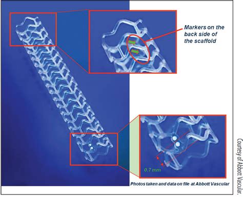 Cardiac Interventions Today - Understanding the Technical Aspects of Bioresorbable Stent ...