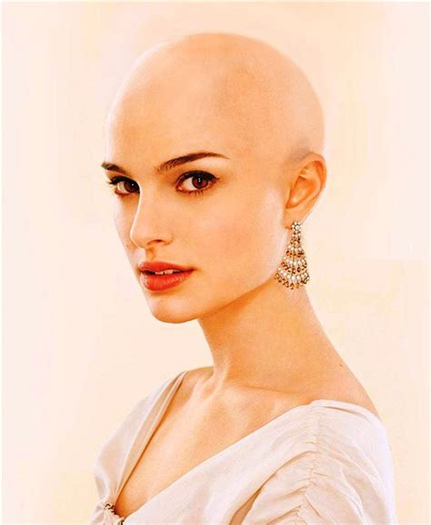 Woman724: GOING BALD? New discoveries