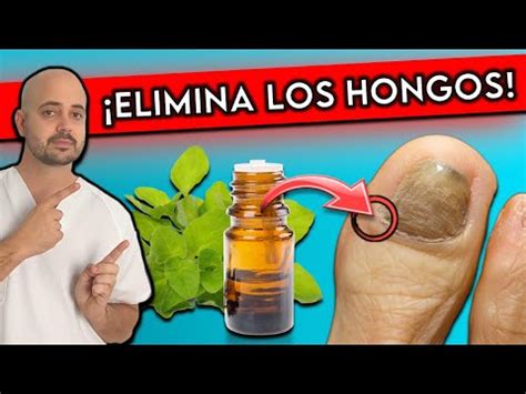 Elimina Hongos De Las U As En Manos De Forma Efectiva