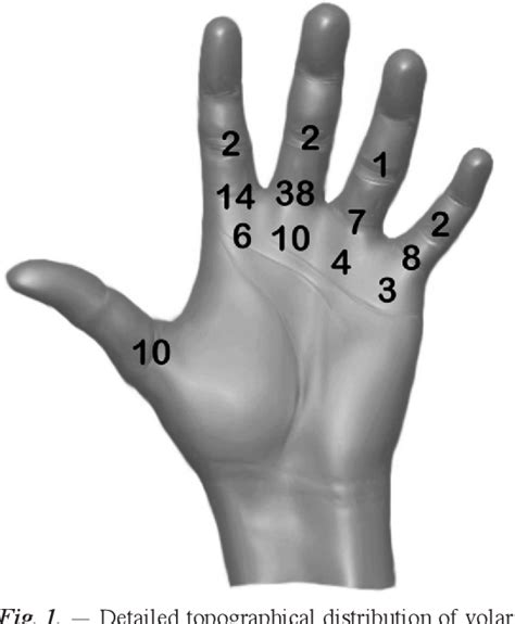 Figure 1 from Volar retinacular ganglions (flexor tendon sheath ganglions) The results of ...