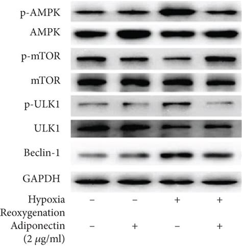 Adiponectin Treatment Counteracts Hypoxia Reoxygenation Induced Ampk