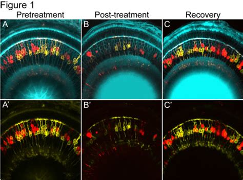 A Time Lapse Series Of Confocal Images Demonstrating Targeted Loss And