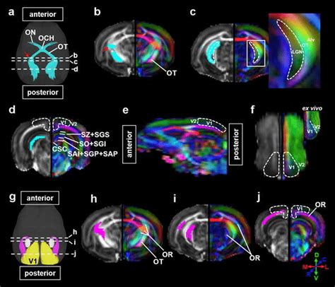 Major Visual Pathways Reconstructed With Deterministic Tractography Download Scientific Diagram